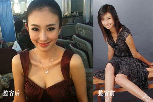 �F�F��������ǰ��Ƭ�ع� �沿�ӵ���׃��(�D)