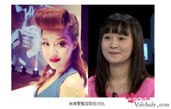 �F��Ę����ǰ�󌦱� �캣�����ݳ�������ȱʧ�弃��